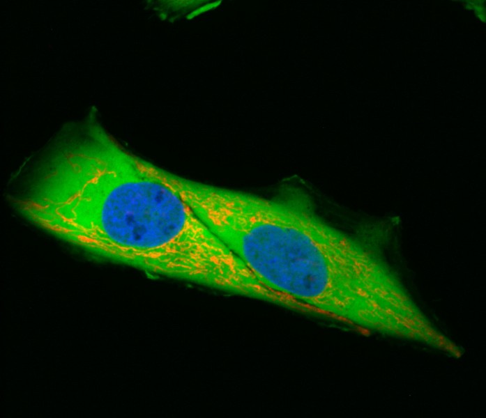 Fluoreszenzfilter